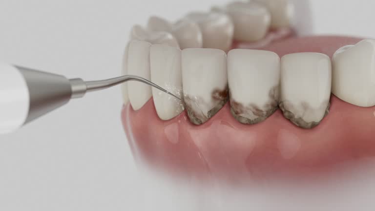 Reliable Dental contractor in Belgrade, MT by Smile Center Dentistry